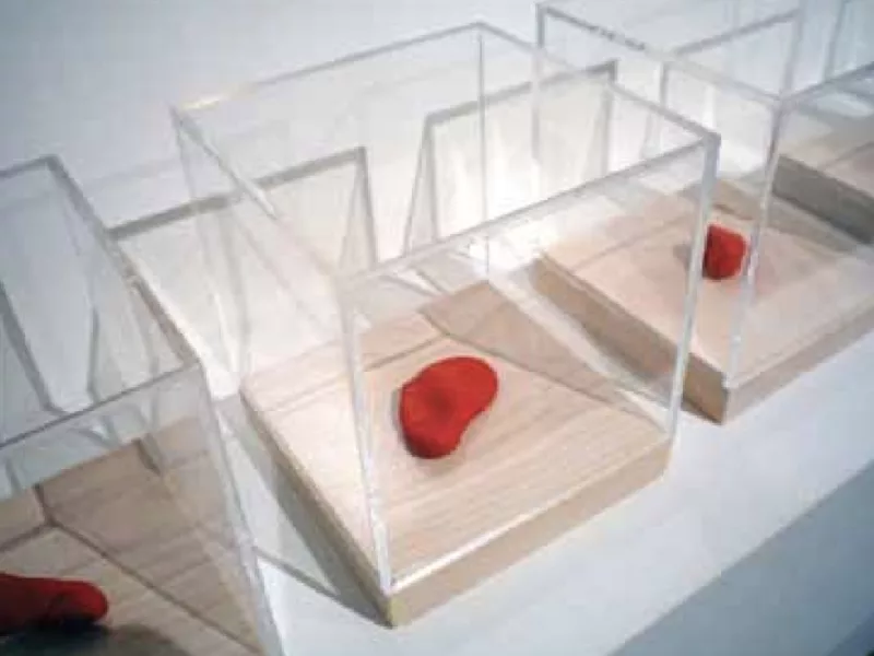 Xử Lý Tiếng Ồn Do Cộng Hưởng Từ Soundboard Piano Cơ (Buzzing Noise)